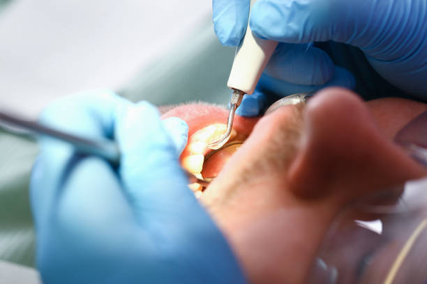 Best Same-Day Emergency Dentist in Hudson, OH